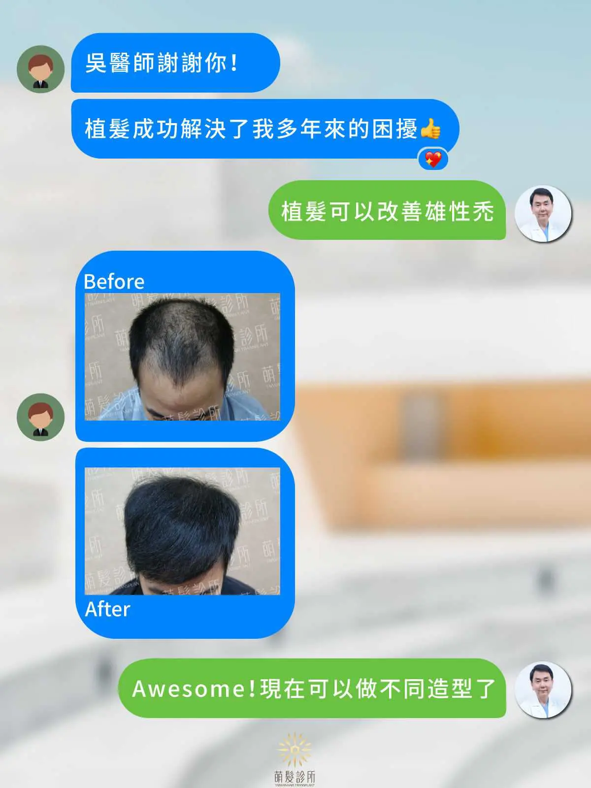 大面積雄性禿植髮供髮區與分期規劃 7