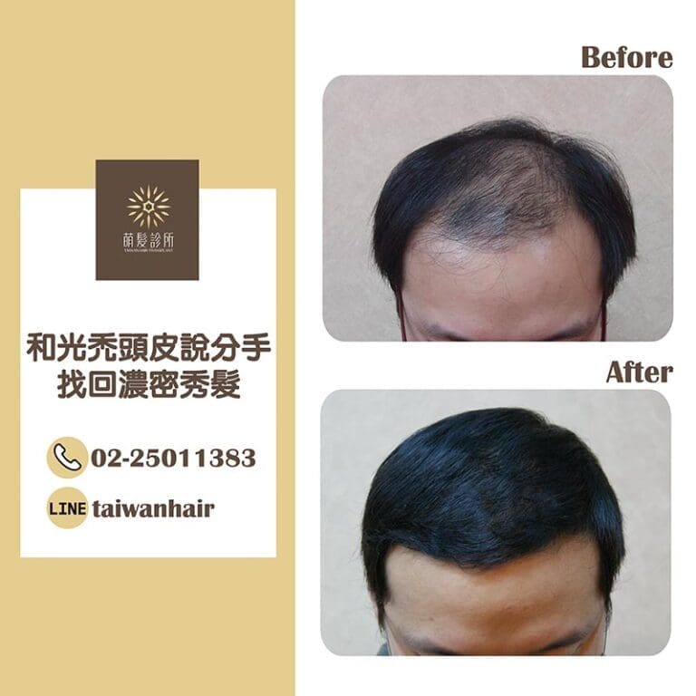 告別冬天「孤單寂寞覺得冷」(FUT 3460株)