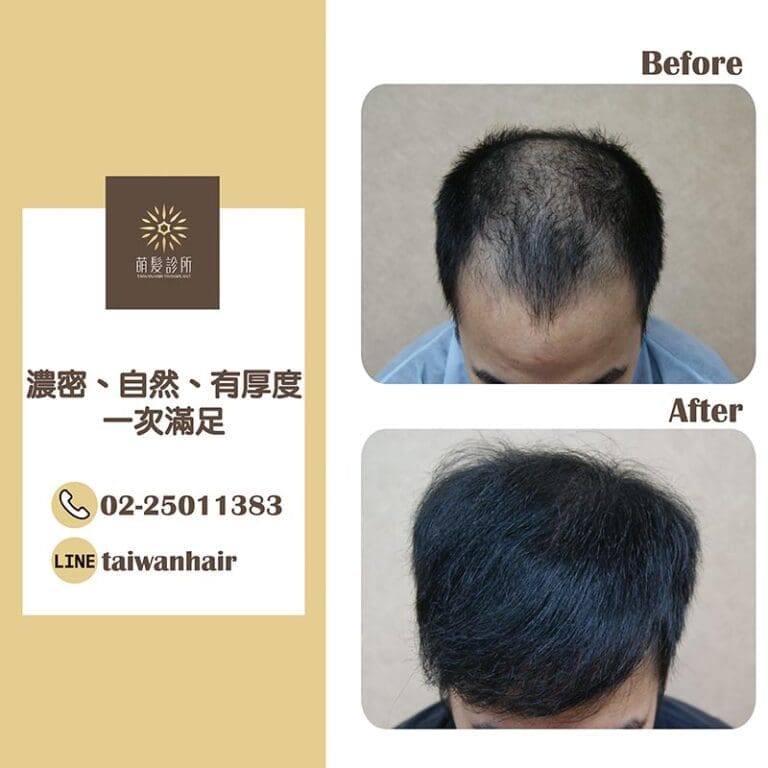 濃密、自然、有厚度，一次滿足 (FUT 3587株)