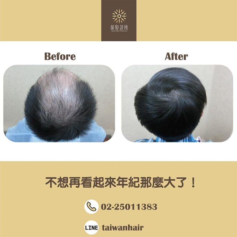 不想再看起來年紀那麼大了！(FUT 3945株)
