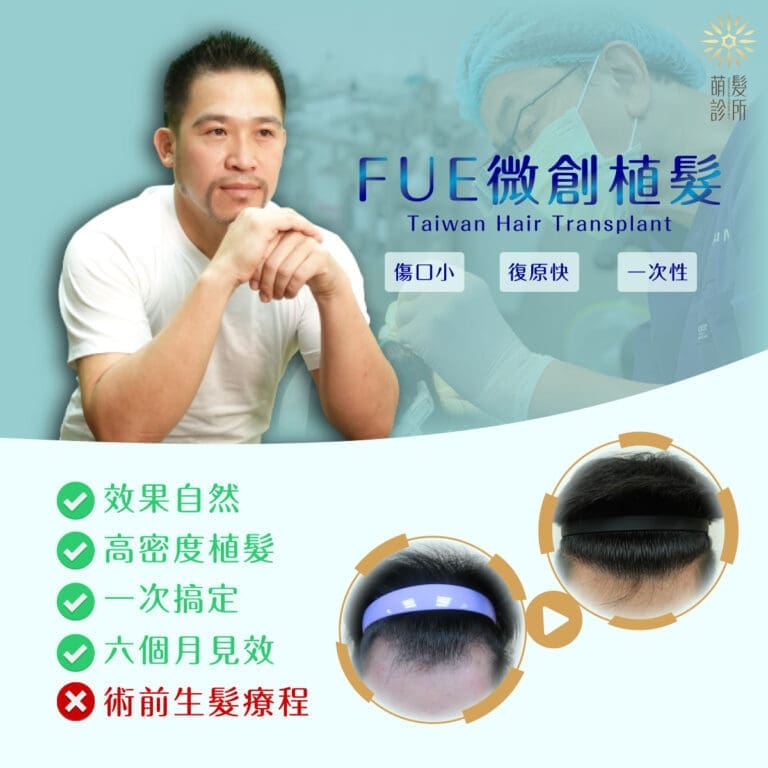 微創植髮植鬍不怕被發現隔天即可上班