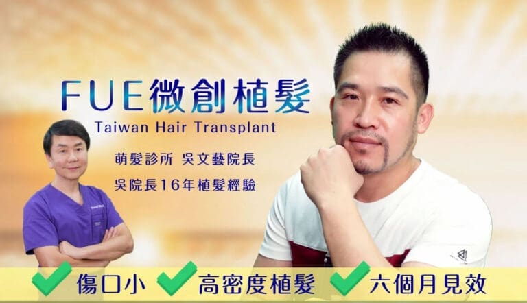 植髮後才發現原來自己是被髮線耽誤的型男