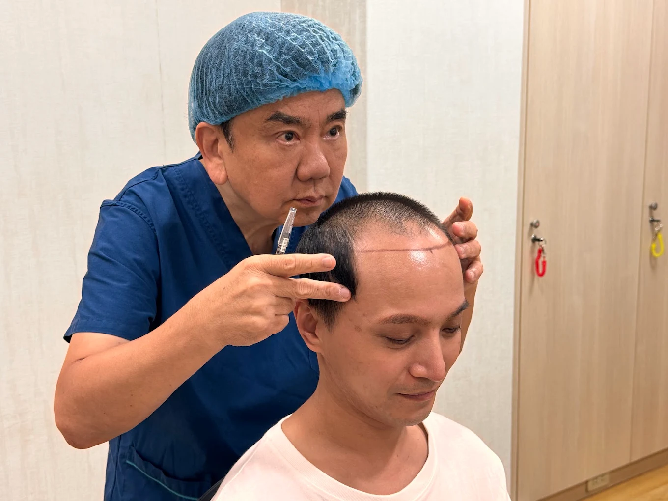 評估植髮範圍與株數規劃