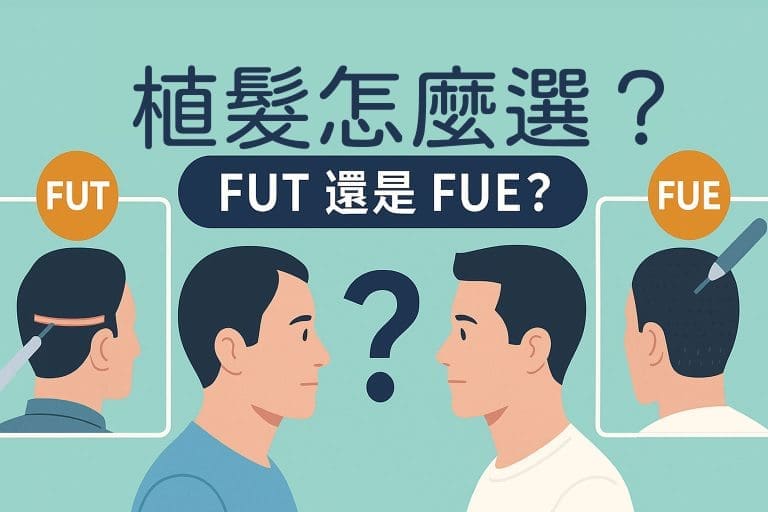FUE、FUT、COMBO植髮怎麼選？差異與適合條件