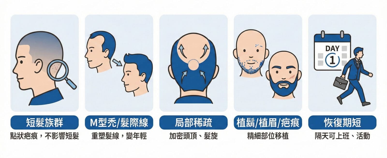 誰適合FUE微創植髮