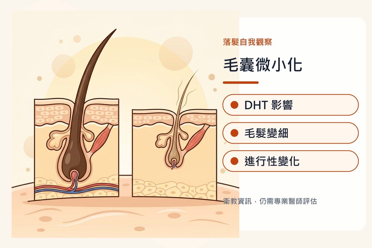雄性禿判斷 1