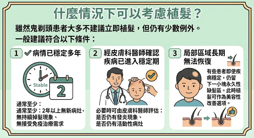 什麼情況下可以考慮植髮