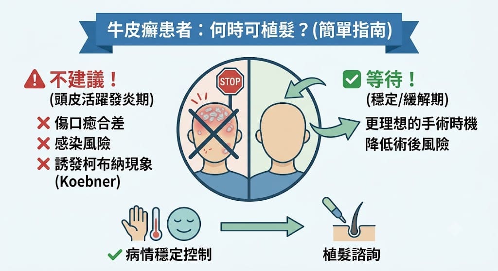 牛皮癬患者可以直接植髮嗎 3